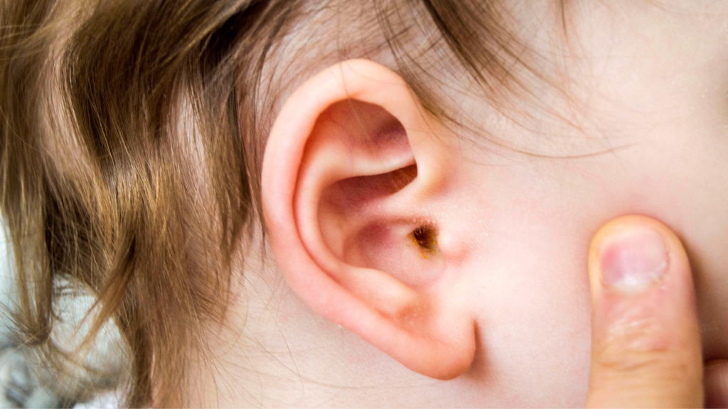 Recurrent Ear and Sinus Infections - Sheila Kilbane, MD