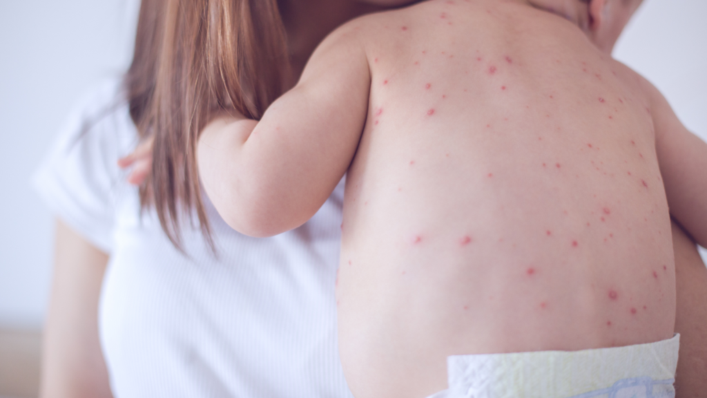 protect against measles