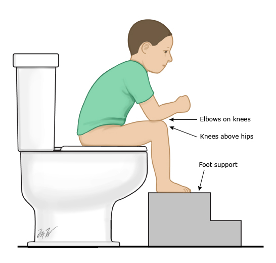 how to help my constipated child with the squatty potty