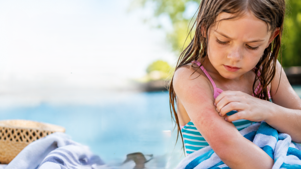 itchy skin after swimming